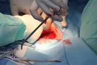 hospital-surgery-medical-health-721241.jpg