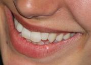 smile-happy-foot-teeth-665433.jpg