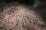 hair-man-hair-loss-head-248048.jpg