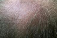 adult-bald-balding-crown-dad-1238997.jpg